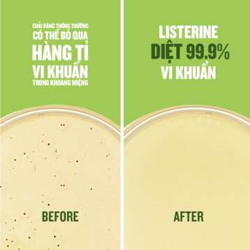 Combo 2 Nước Súc Miệng Listerine Trà Xanh Ngừa Sâu Răng 750ml