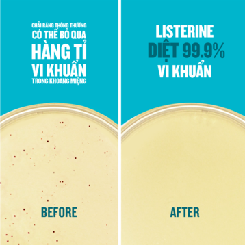 Nước Súc Miệng Listerine Hơi Thở Thơm Mát 750ml