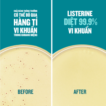 Nước Súc Miệng Listerine Hơi Thở Thơm Mát Không Cay 750ml